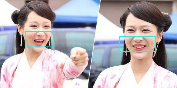 杨紫近照曝光无修图法令纹很深,杨紫面部填充法令纹