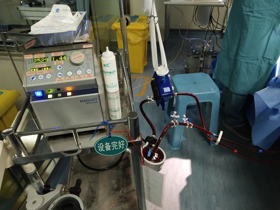 爆发性心肌炎应用ecmo治愈几率,暴发性心肌炎ecmo使用后存活率