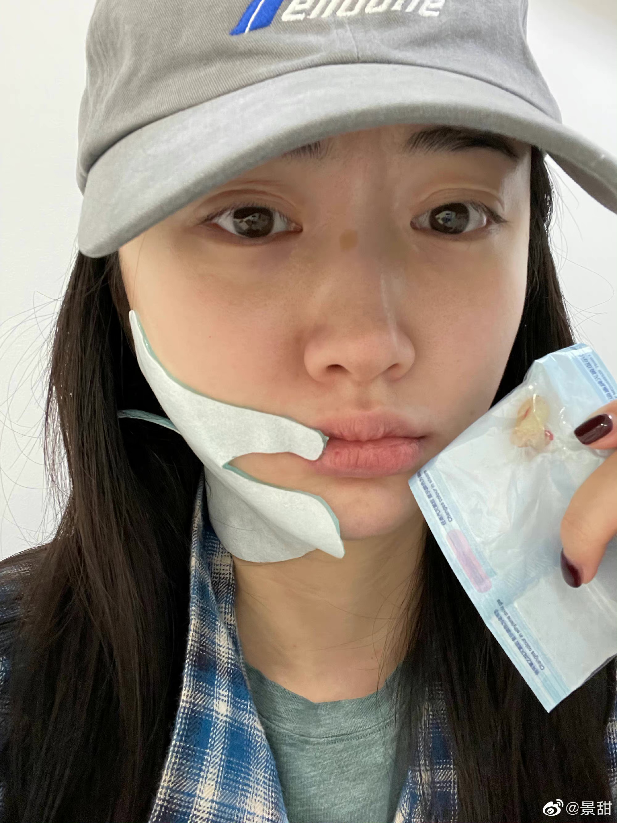 景甜拔牙后自拍照,景甜拔牙后的自拍照