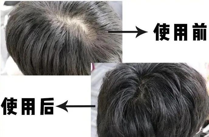 日本蒙琉洗发水,蒙古防掉发洗发水