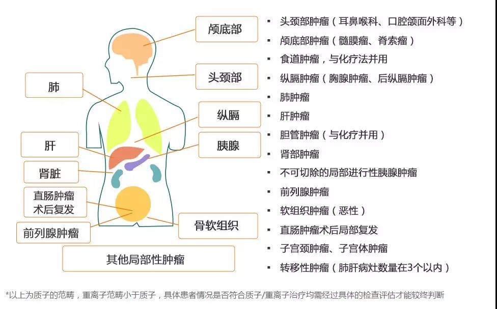 质子重离子应用得多吗,质子重离子是什么疾病