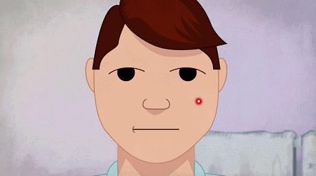 战痘经验分享,战痘第一步先要认清痘痘的类型