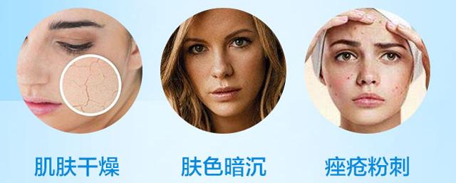 去粉刺收缩毛孔最好的方法,医美收缩毛孔最有效的方法