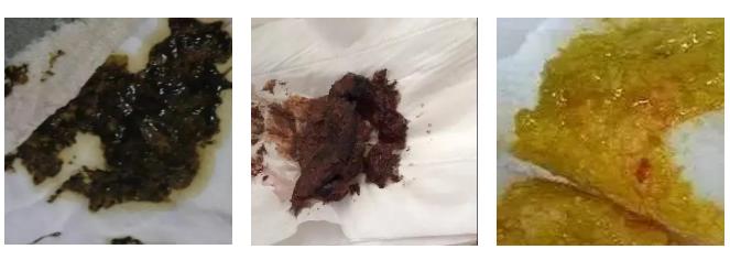 吐奶怎么确定是否奶粉过敏,宝宝喝奶粉频繁吐奶是假奶粉吗