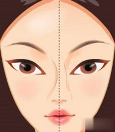 印堂有一条线凸起面相,女性印堂有点低线的面相
