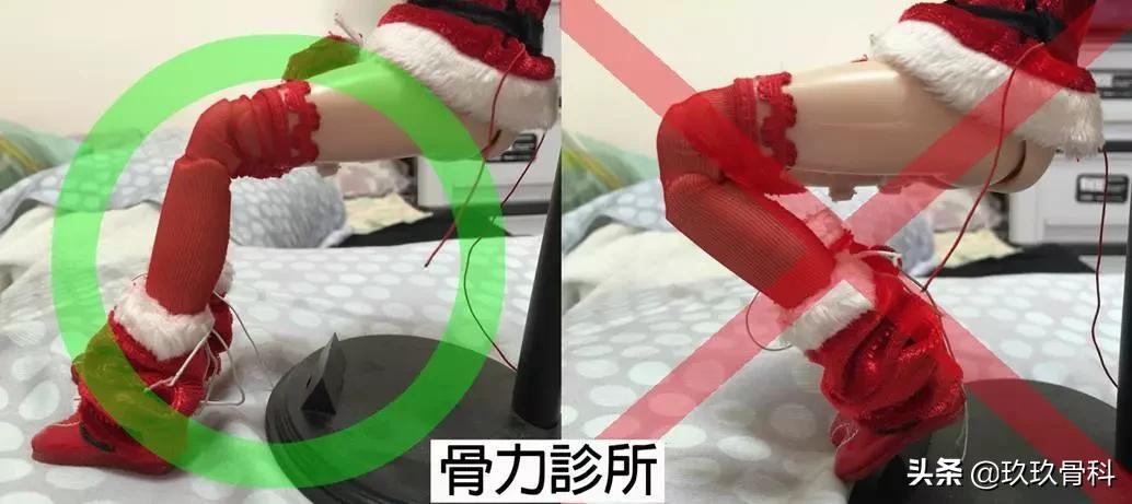 鹅足肌腱炎是不是膝关节炎,不明原因脚筋痛