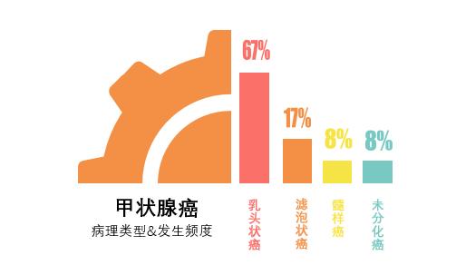 甲状腺癌一般寿命有多长,滤泡性甲状腺癌寿命