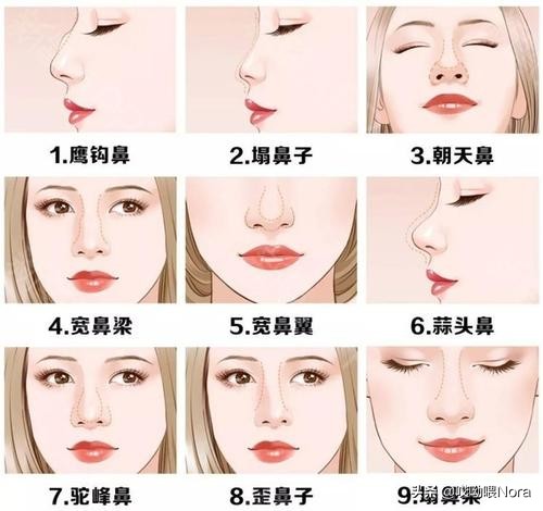 最自然的小翘鼻,鼻综合小翘鼻图片