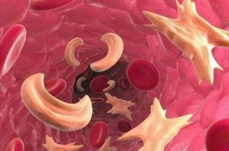 江苏发现2例全球罕见黄金血型,江苏发现一例超稀有血型