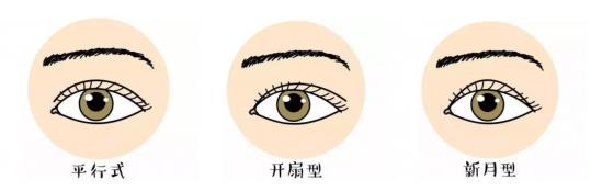 欧式改韩式双眼皮是怎么改的,日式双眼皮韩式双眼皮哪个好看