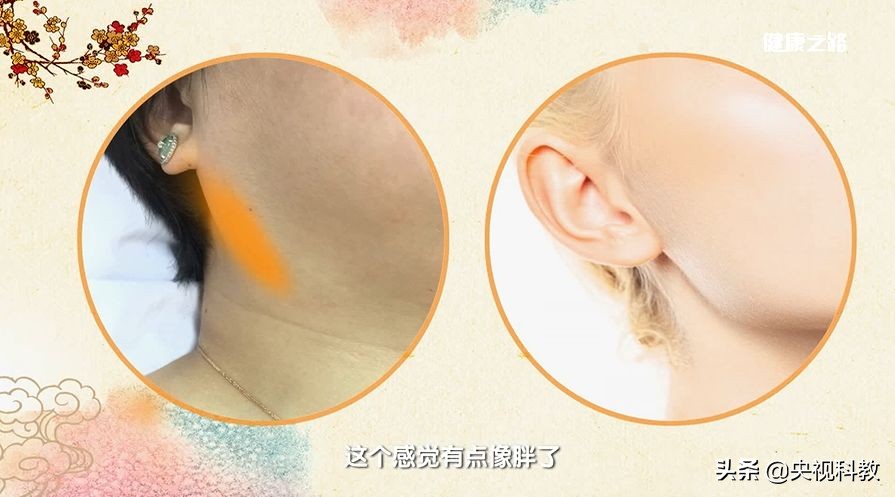 去除肌瘤囊肿中药,身上长结节息肉肌瘤怎么治