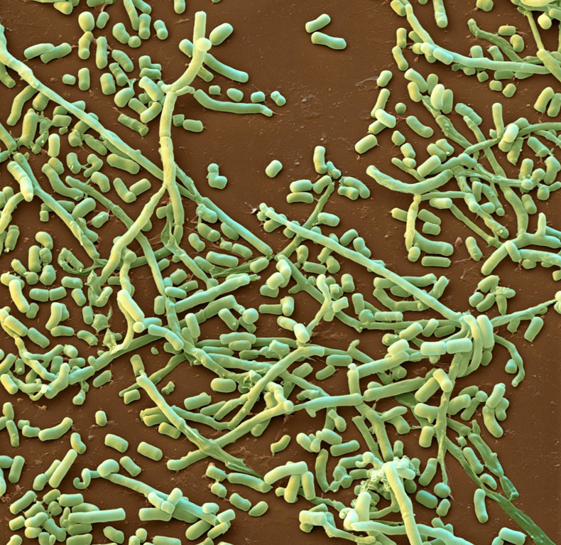 霉菌会引起皮癣吗,霉菌感染就是癣吗