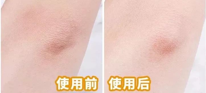 黑皮克星上线！澳洲销量第一羊奶皂，马云点赞，李佳琦直播打call