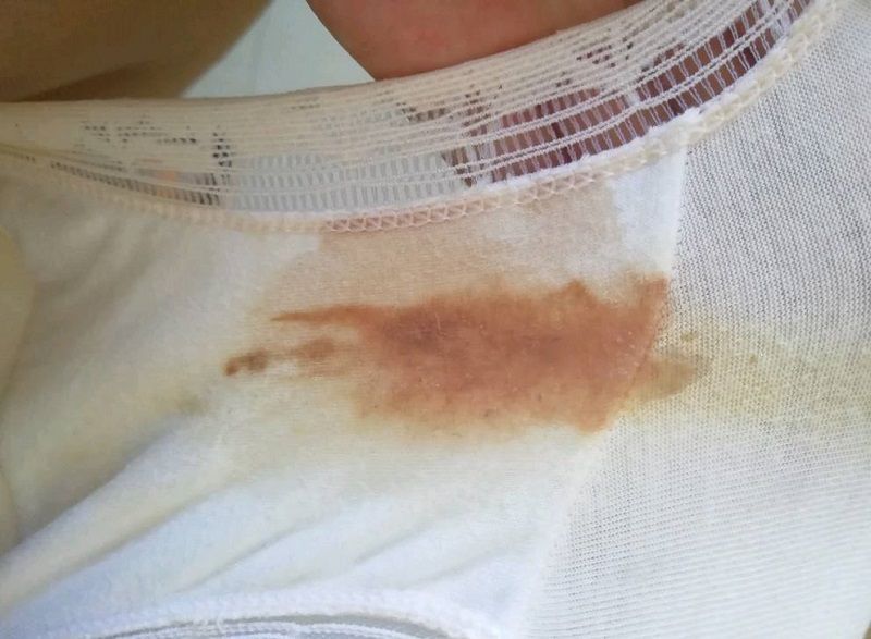 孕妈发现有分泌物,孕中期内裤上黄分泌物正常吗