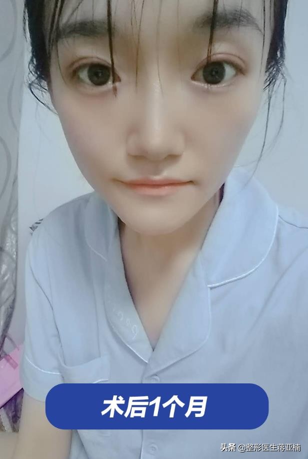 青春期如何不长痘还变美,青春不留痘原版视频