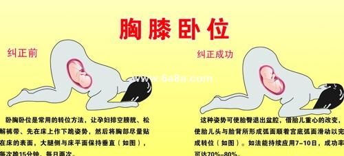 胎位不正艾灸的正确方法,胎位不正艾灸的正确熏法图片