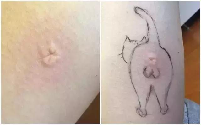 驱蚊止痒排行榜,驱蚊止痒真实测评