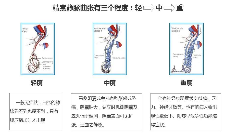 蛋蛋按压疼是不孕不育吗,睾丸疼痛会不会导致不育