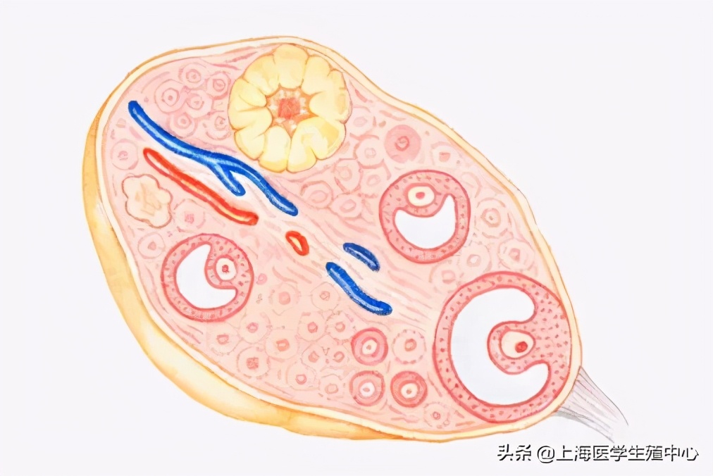 试管婴儿取完卵防止腹水,试管婴儿取完卵后注意哪些事项