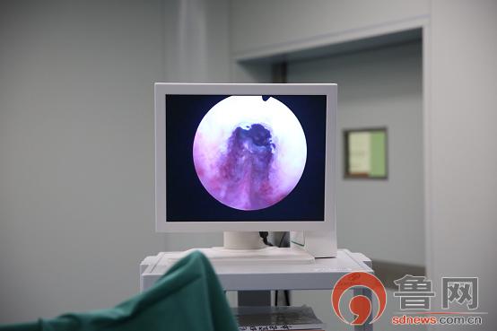 百岁老人命悬一“腺”*安泰**市中医医院泌尿外科主任游波妙手解病痛