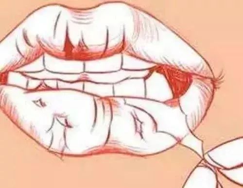 舔舔舔!唇炎找上门来怎么办?!