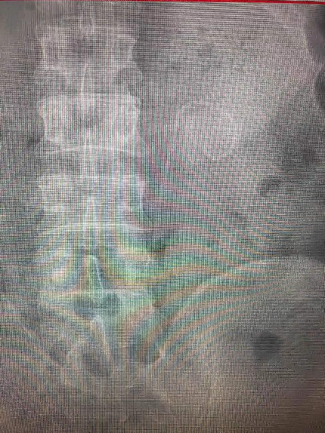 宝璋医院,利辛县宝璋医院泌尿外科怎么样