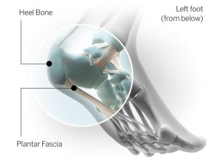 跑者足底力量训练动作,跑者足底疼痛怎么有效解决