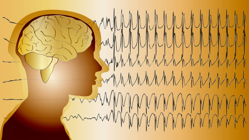孩子失神癫痫频繁小发作怎么预防,预防癫痫发作的措施有哪些