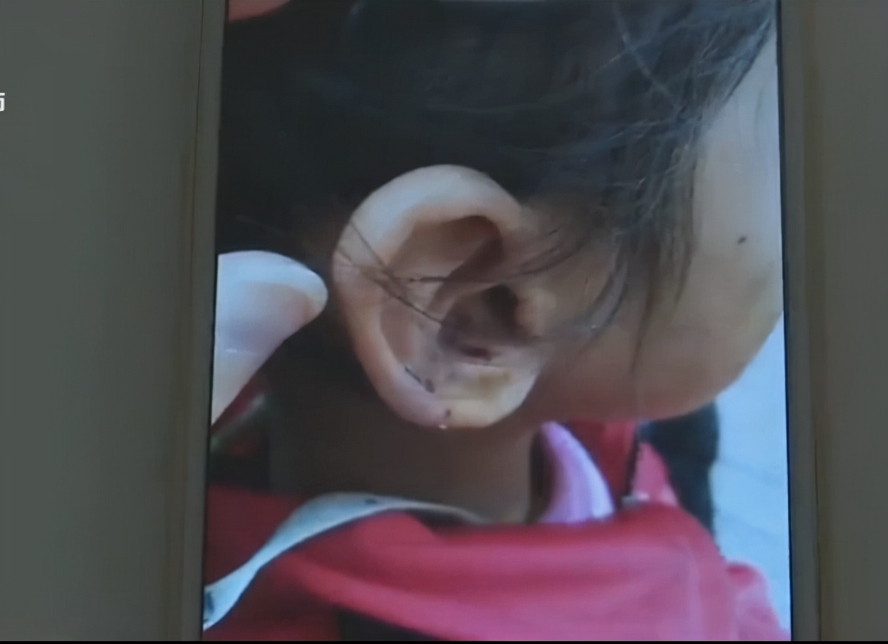 六岁女童遭亲生母亲虐待后续报道,6岁女孩被亲妈虐待事件完整