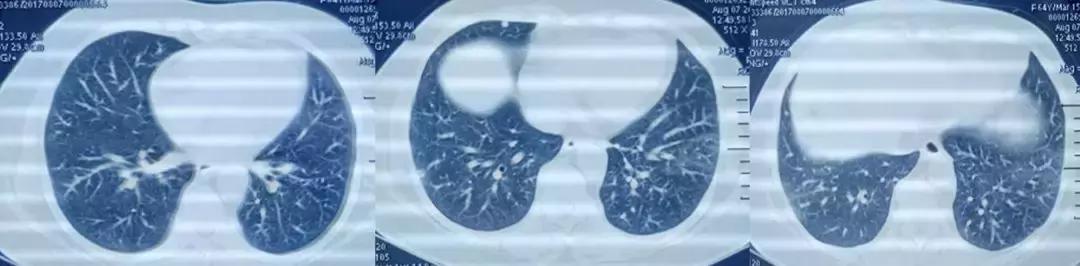 抗菌药物不合理处方分析,抗菌药物用药不合理的表现