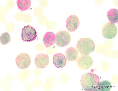 肿瘤标志物检测的常见问题,6种肿瘤标志物