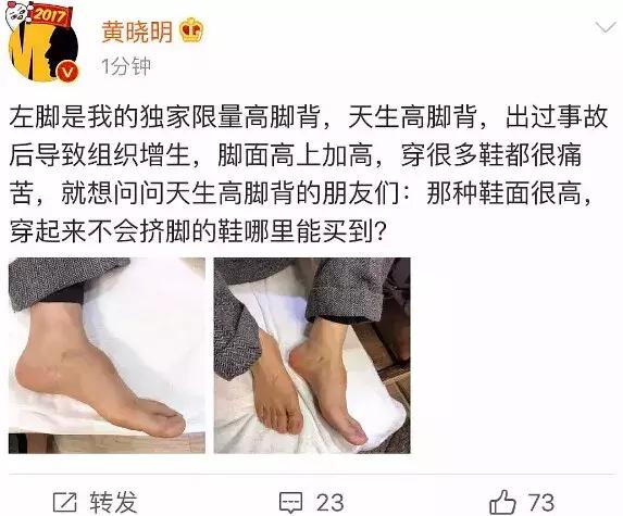 黄晓明回应“增高鞋垫”风波，高脚背的人，到底该如何选鞋？
