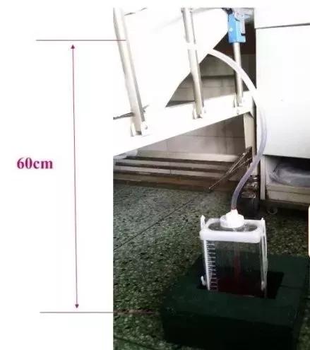 护士观察瞳孔注意事项,胸腔闭式引流的护理及注意事项