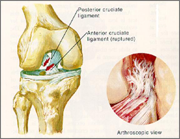 沈杰威北京积水潭医院,北京积水潭医院沈杰威怎么样