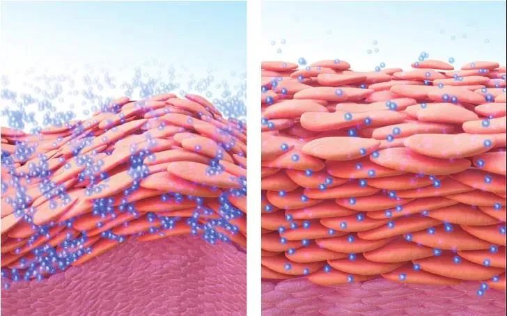 大医生指导夏季宝宝湿疹应对妙法,宝宝预防湿疹护肤品
