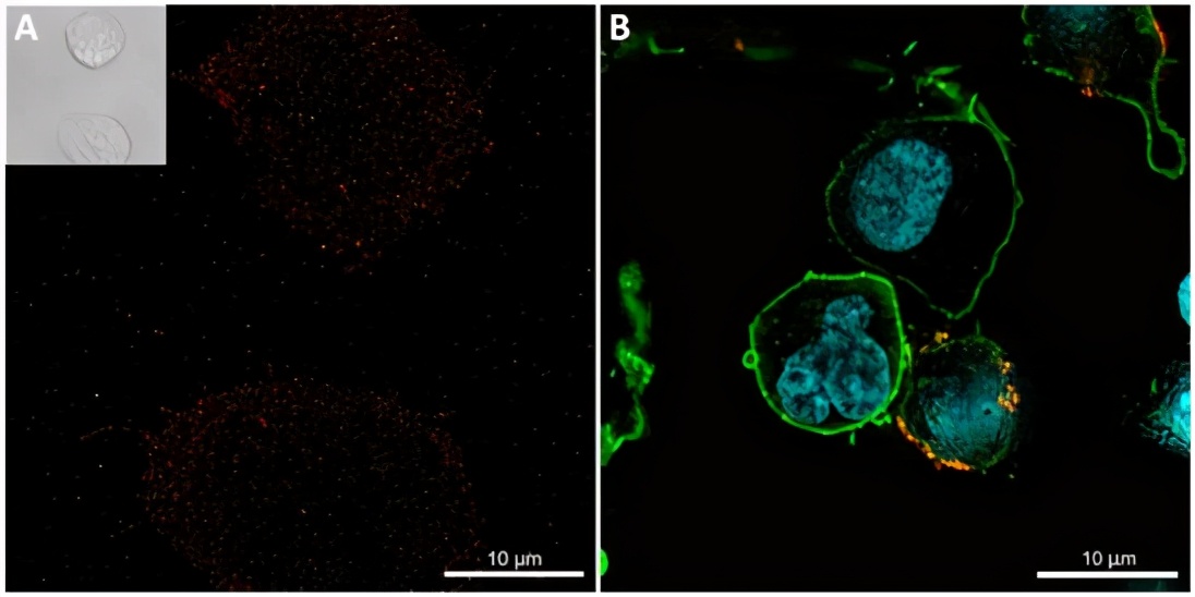 car-t治疗多发性骨髓瘤成功率,car-t细胞疗法能让骨髓瘤痊愈吗