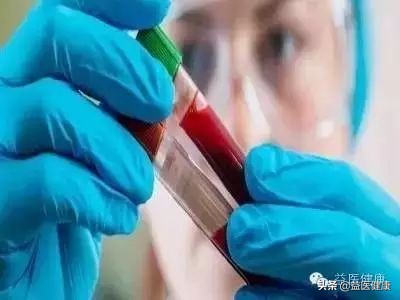 早筛癌症影像检查项目有哪些,体检癌症指标筛查能发现早癌吗