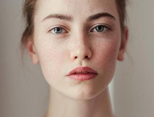 身体上的毛发变白是怎么回事,发现自己皮肤越来越白是病态吗