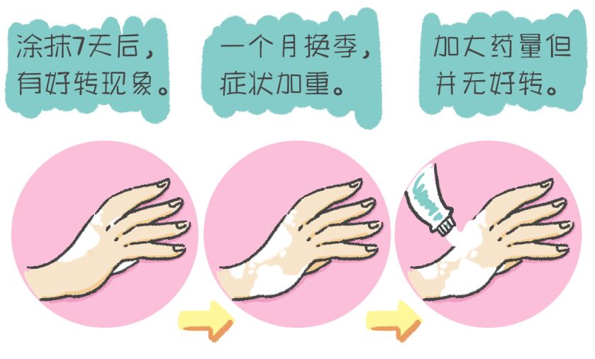 辽宁省白癜风专项诊疗补贴,白癜风专项资助