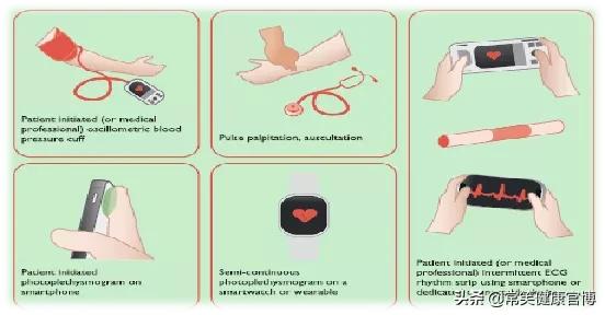 欧洲房颤指南,房颤最新指南解读