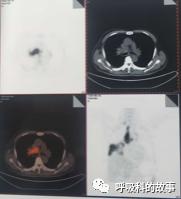 怎么应用统计学做调查,统计学方法可以解决的主要问题