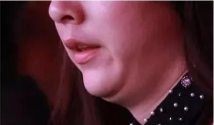 双下巴,嘟嘟肉,成年人的婴儿肥到底该肿么办?