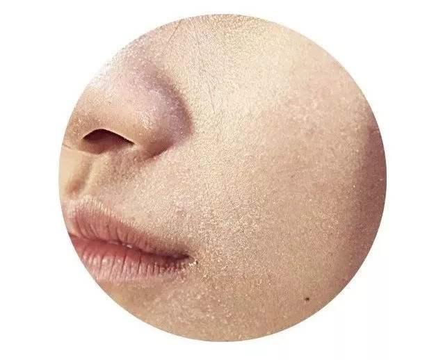 皮肤暗黄有斑点适合用哪些护肤品,35岁皮肤暗黄用哪个牌子护肤品好