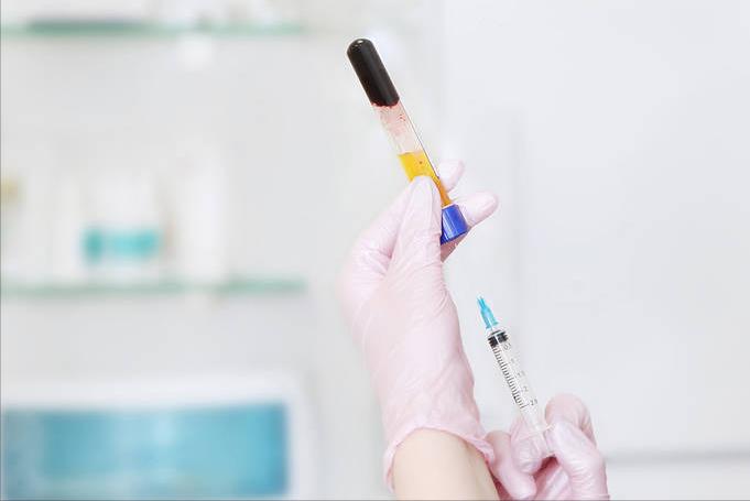 植发后怎么才能长得更好,植发之后和本来的头发有区别吗