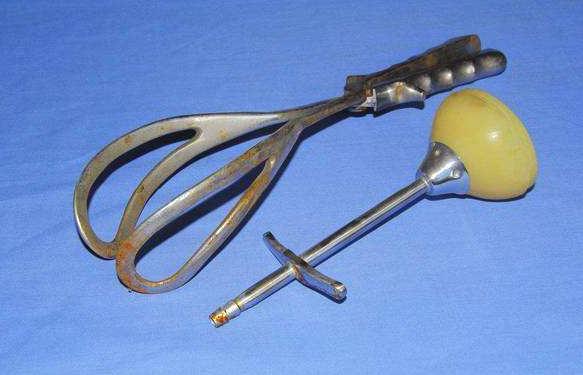 产钳助产会伤到面部吗,产钳助产有伤害吗