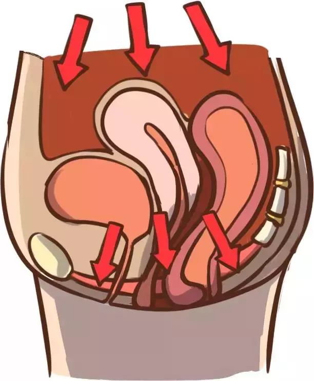 自治区中医院开发区医院｜“笑尿了”女性朋友要注意