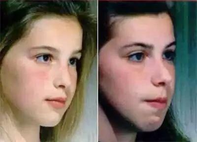 比整容更有效的变美习惯,不整容不动刀的变美秘籍