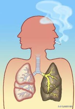 抽烟的肺部和不抽烟肺部对比,抽烟对肺部的影响有哪些
