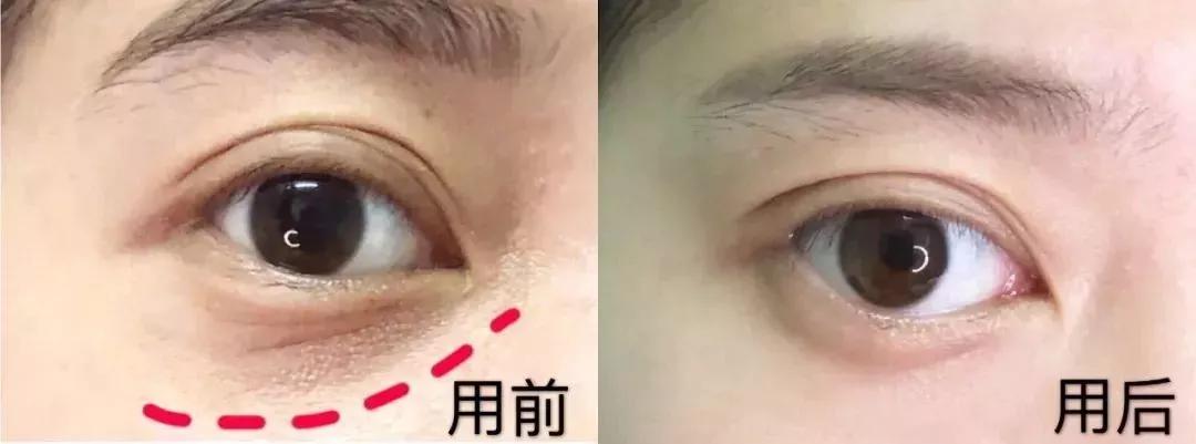 雅诗兰黛日本产的眼霜,用了雅诗兰黛皱纹更明显了