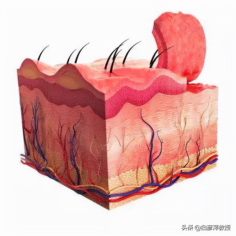 皮肤瘙痒红肿有风团,皮疹伴疼痛的皮肤病